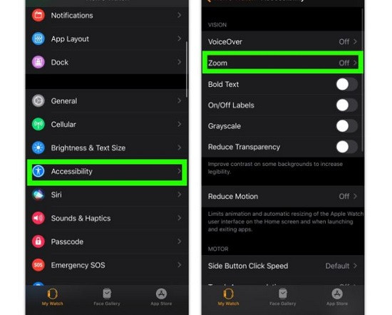 Tắt Zoom Apple Watch trên iPhone
