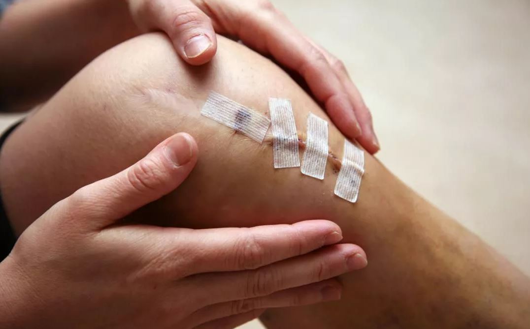 phòng ngừa đứt dây chằng chéo trước